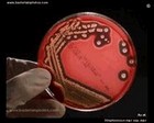 streptococcus equi